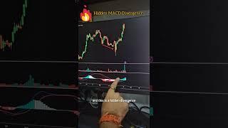  Secret MACD Divergence Strategy  Unlock Hidden Reversals & Catch Momentum Shifts BEFORE Anyone 