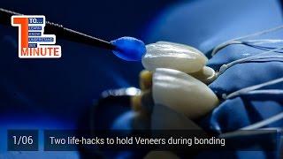 Two life-hacks to hold Veneers during bonding. Episode 1/6