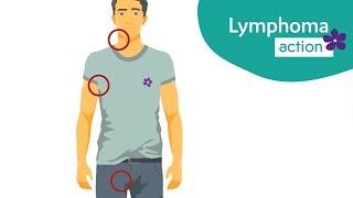 The symptoms of lymphoma