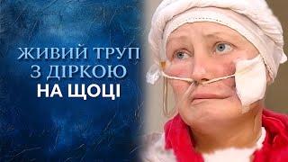 ШОК! Женщина-зомби | Можно ли помочь живому трупу?  Говорить Україна. Архів