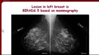 Breast Elastography