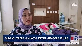 IRT di Bangka Belitung Buta Usai Dianiaya Suami Pakai Linggis