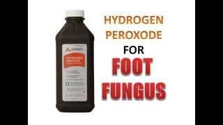 Hydrogen Peroxide For Foot and Toenail Fungus