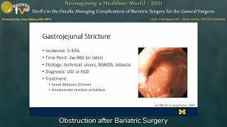 Obstruction after Bariatric Surgery