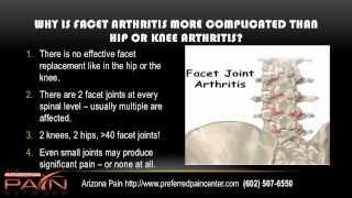 Basics of Facet Syndrome (Facet Arthritis) from an AZ pain clinic (602) 507-6550