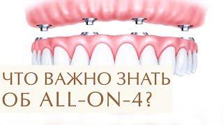В каких случаях стоит выбрать систему имплантации зубов все на 4. Имплантация зубов все на 4. 12+