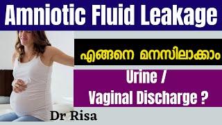 Amniotic Fluid Leakage In Pregnancy Malayalam | Leaking Amniotic Fluid