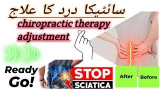 سائٹیکا درد کا علاج - Sciatica Pain Treatmen a