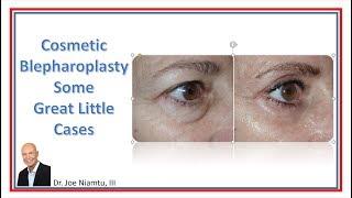 Cosmetic Blepharoplasty: Some Great Little Cases