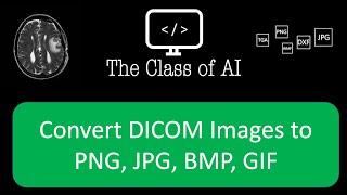 Convert DICOM Images to PNG, JPG, BMP, GIF