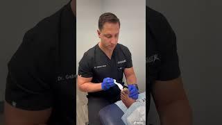 Fungal Nail Removal: Dr. Galan’s Expert Removal Technique | Toe Doc TV