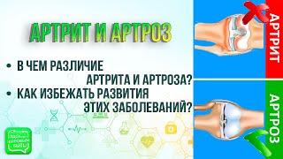 АРТРИТ и АРТРОЗ | Как избежать развития этих заболеваний?