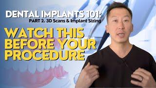 Dental Implants 101: What You NEED to Know! Part 2 (3D Scans & Implant Sizing)