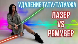 Удаление тату/татуажа. Лазер vs Ремувер