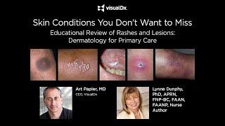 Skin Conditions You Don't Want to Miss