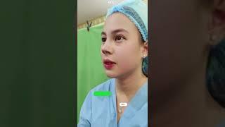 OPERASI HIDUNG MANCUNG, RHINOPLASTY BEFORE DAN AFTER #operasihidungmancung #rhinoplasty #oplashidung