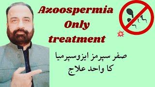 Homeopathy for Azoospermia: Does it Really Work? Only option of Azoospermia with homeopathy.