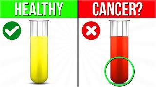 THIS Is What The Color Of Your PEE Is Warning You About Your Health