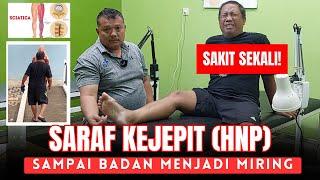 SARAF KEJEPIT (HNP) SAMPAI BADAN MENJADI MIRING SAKIT SEKALI