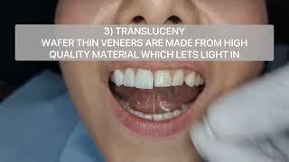 3 things that make veneers look super natural! Upper 6 non cutting veneers case by Dr Aleem