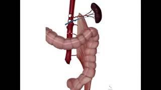 A Complicated Case of Splenic Injury after Colonoscopy