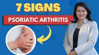 Psoriatic Arthritis -7 Signs and Symptoms | A Rheumatologist Review