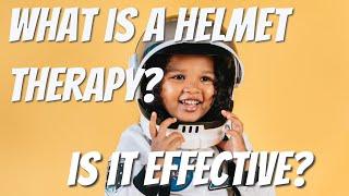 WHAT IS A HELMET THERAPY? IS IT EFFECTIVE?