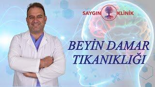 Beyin Damar Tıkanıklığı Tedavileri