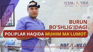 Burun bo`shlig`i poliplari haqida muhim ma`lumotlar