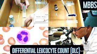 Differential Leucocyte Count (DLC) Practical | (MUHS) | #mbbs #physiology #hematology