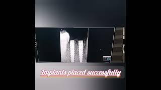 #implant dentistry #best#dentist#bookyourappointment#dentalclinic#viralshort#dentistry#trendingshort