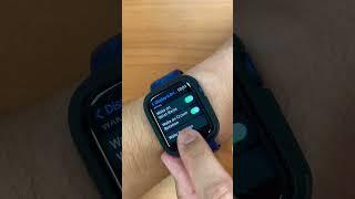 Nursing Tips using an Apple Watch #apple #applewatch #nurse #nursing #nursing #nursestudent #vitals