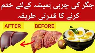 BEST DIET For FATTY LIVER| FATTY LIVER DIET fatty liver ka Ilaj