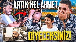 Ahmet'in saçı artık yok