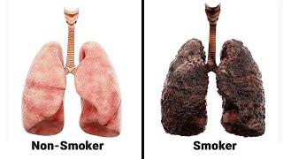 iQOS vs Traditional Regular Smoking - Lungs Harm Comparison