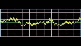 Anti-Aging - Rife Frequencies