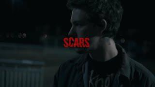 FREE | "scars" | HARD BRENNAN SAVAGE TYPE BEAT | Scarxcrow