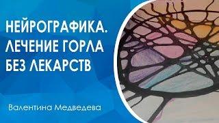 Нейрографика. Лечение простуды и боли в горле без лекарств.