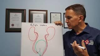 Ectopic ureters