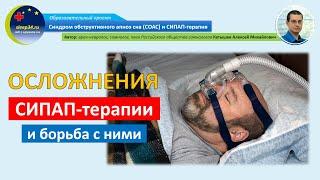 #28: Осложнения СИПАП терапии и борьба с ними | СОАС и СИПАП-терапия