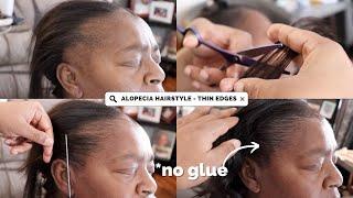 THIN EDGES TRANSFORMATION | TRACTION ALOPECIA HAIRSTYLE