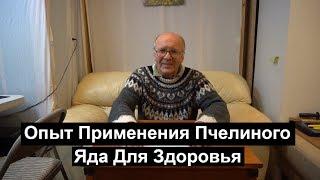 №32 Опыт Применения Пчелиного Яда Для Здоровья. Пчеловодство.Пасека.