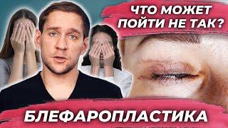 Блефаропластика - что может пойти не так? Бадак Олег Евгеньевич.