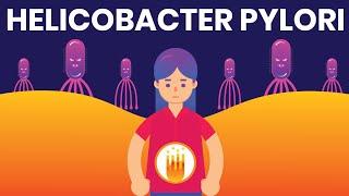 Helicobacter pylori (H. pylori) & Peptic Ulcer Disease