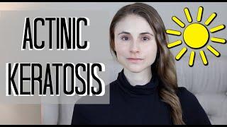 Actinic keratosis removal, treatments, and prevention| Dr Dray