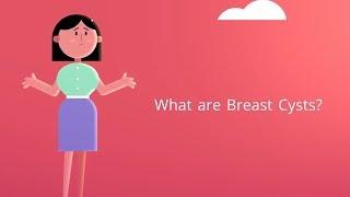 What are Breast Cysts? (Fluid-filled Sac in Breast)