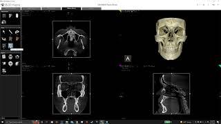 Customizing views in CS 3D Viewing Software and CS 9600 CBCT