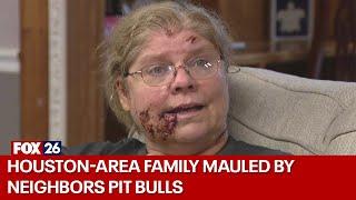 Montgomery County family mauled by pit bulls in horrific attack, needed surgeries