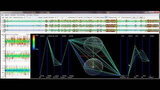 Visualization of Large, Time-Dependent Data with Integrated Spherical and Parallel Coordinates