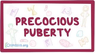 Precocious puberty (Year of the Zebra)